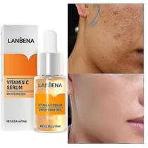 Sérum facial, vitamina C, clareador de manchas, 15 ml, cuidados com a pele Sérum facial, vitamina C, clareador de manchas, 15 ml, cuidados com a pele