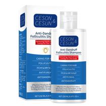 Shampoo Ceson&Cesun Antifúngico/Anticaspa 2 em 1 Shampoo Ceson&Cesun Antifúngico/Anticaspa 2 em 1