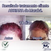 Shampoo Crescimento Capilar Acelerado