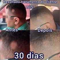 Shampoo Crescimento Capilar Acelerado