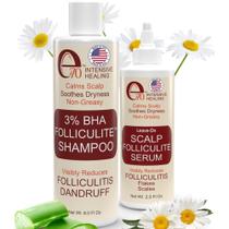 Shampoo e sérum e70 Tratamento de foliculite 237ml+59ml