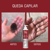 Shampoo SOS Crescimento 300ml Lizz ante Crescimento Acelerado Preenche Falhas Combate Calvice Aumento Volume Massa Capilar Combate Caspa Oleosidade
