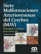Siete malformaciones arteriovenosas del cerebro (mav)