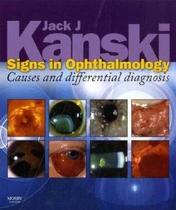 Signs in ophthalmology - causes and differential diagnosis - expert consult - Elsevier (import)