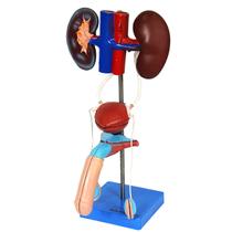 Sistema Urinário Masculino em 6 Partes, Anatomia Sistema Urinário Masculino em 6 Partes, Anatomia