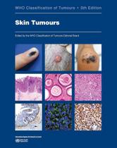 SKIN TUMOURS, Autor: WHO SKIN TUMOURS, Autor: WHO