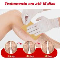 Solução Para Varizes Vasos Veias - Kit com 10