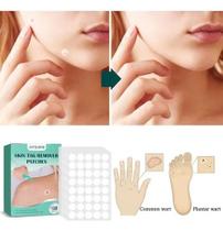 Solução Verruga Pescoço Axila Adesivo Skin Tag Remover Tratamento 36 Patches Original Top Solução Verruga Pescoço Axila Adesivo Skin Tag Remover Tratamento 36 Patches Original Top