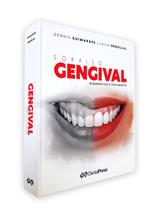 Sorriso gengival - diagnóstico e tratamento - Dental Press