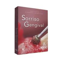 Sorriso gengival - Quintessence nacional