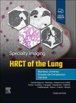 Specialty imaging hrct of the lung Specialty imaging hrct of the lung