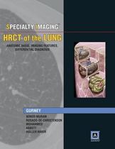 Specialty Imaging Hrct Of The Lung