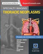 Specialty imaging: thoracic neoplasms - AMIRSYS