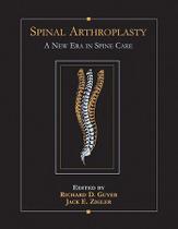 Spinal arthroplasty