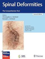 Spinal deformities the comprehensive text - THIEME PUBLISHERS INC 2024