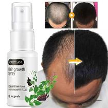 Spray de crescimento capilar Wokex Anti Hair Loss 20mL para homens e mulheres