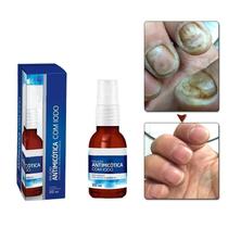 Spray De Iodo Para Micose De Unha - Trata Fungos E Unha Amarela Do Pé - Solução Prática 30ml Spray De Iodo Para Micose De Unha - Trata Fungos E Unha Amarela Do Pé - Solução Prática 30ml