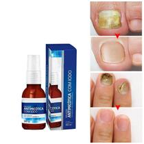 Spray Para Unha Com Aspecto De Vidro Quebrado - Micose E Fungo - Iodo Líquido Concentrado 30ml Spray Para Unha Com Aspecto De Vidro Quebrado - Micose E Fungo - Iodo Líquido Concentrado 30ml
