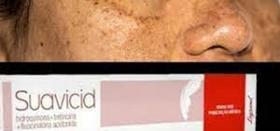 SUAVICID Líder no tratamento de melasma, manchas solares e de acne 15 gr