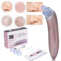 Super Aparelho Removedor de Cravos e Espinhas Peeling Recarregável MC2003RS Super Aparelho Removedor de Cravos e Espinhas Peeling Recarregável MC2003RS