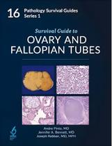 Survival Guide To Ovary And Fallopian Tubes Survival Guide To Ovary And Fallopian Tubes