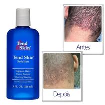Tend Skin 118ml