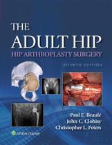 The adult hip: hip arthroplasty surgery