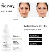 The Ordinary Hyaluronic Acid 2% + B5 - 30ml