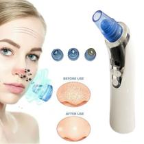 Tira Cravos Eletrico A Vacuo Aparelho Removedor De Espinha - Beleza Tira Cravos Eletrico A Vacuo Aparelho Removedor De Espinha - Beleza