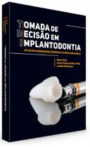 Tomada de decisão em implantodontia atlas de abordagens cirúrgicas e restauradoras - Santos Publicações
