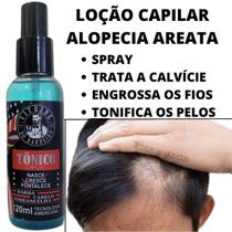 Tônico Anti Alopecia Areata Unissex Em Spray - Vitrine Do Barbeiro
