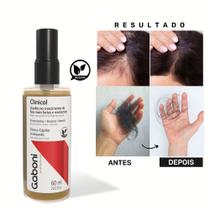 Tônico Capilar de Crescimento e Antiqueda Clinical 60ml Gaboni