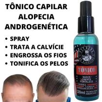 Tônico Capilar Spray Anti Alopécia Androgênetica Anti Caspa!