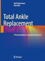 TOTAL ANKLE REPLACEMENT, Autor: HINTERMANN / BEAT HINTERMANN, ROXA RUIZ