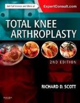 Total knee arthroplasty