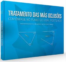 Tratamento das mas oclusões - com ênfase no plano oclusal posterior - Santos Publicações Tratamento das mas oclusões - com ênfase no plano oclusal posterior - Santos Publicações