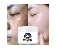 Tratamento estético facial Melasma Cream 30g
