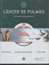Tratamento Multidisciplinar do Câncer de Pulmão - Dendrix Edicao E Design Ltda