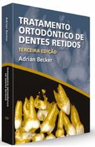 Tratamento ortodôntico de dentes retidos - Santos Publicações