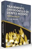 TRATAMENTO ORTODÔNTICO DE DENTES RETIDOS - Santos Publicações