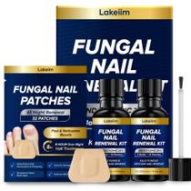 Tratamento para Fungos nas Unhas Lakeim Ácido Undecilênico 25% 2x30ml