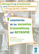 Tratamiento de Las Secuelas Traumáticas del Retropié Tratamiento de Las Secuelas Traumáticas del Retropié