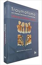 Traumatismo em dentes decíduos e permanentes - ciência na prática clínica - Santos Publicações