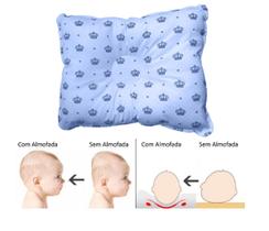 Travesseiro Cabeça Chata Plagiocefalia Grande Bebê a partir de 3 meses