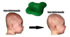 Travesseiro Plagiocefalia Cabeça Amassada Do Bebê