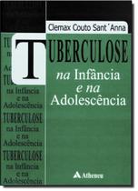 Tuberculose na infancia e na adolescencia