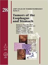 Tumors of the esophagus and stomach