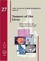 Tumors of the liver (afip atlas of tumor pathology series 4)