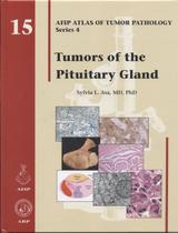 Tumors of the pituitary gland (afip atlas of tumor pathology) - American Registry Of Pathology (afip)