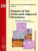 Tumors of the testis and adjacent structures - Eurospan Group
